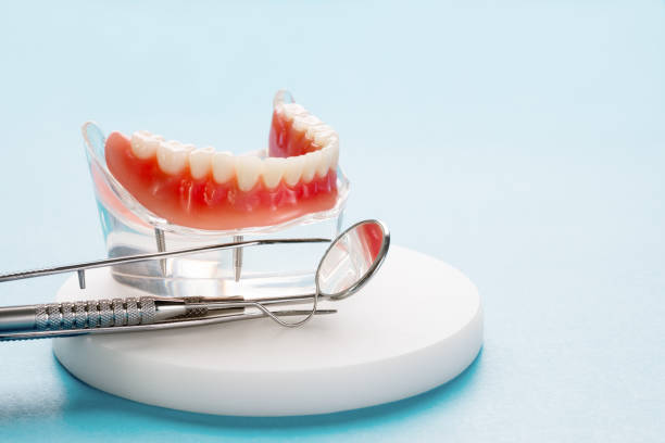 Full Mouth Reconstruction in Lonoke, AR